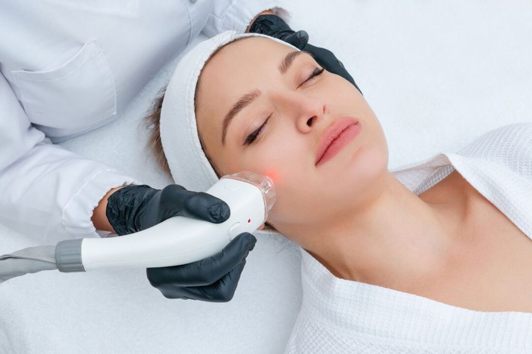 Laser facial rejuvenation