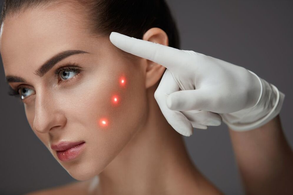 Preparation for laser skin rejuvenation