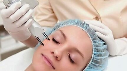 The laser of the face rejuvenates vitality