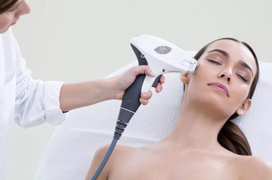 Laser field rejuvenation